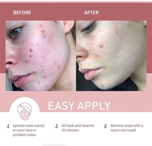 Pore Minimizing Clay Mask