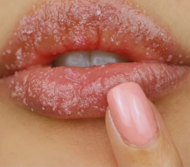 Lip Lightening Combo